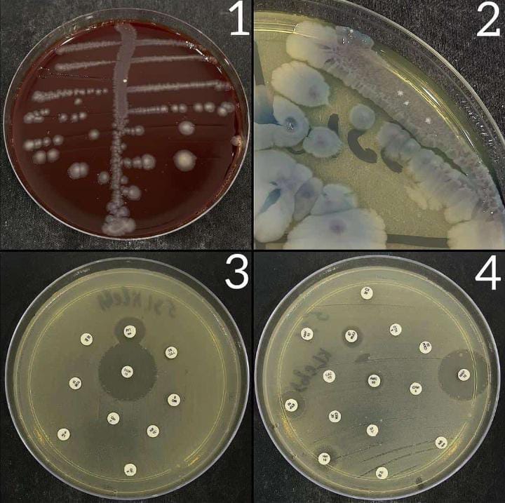 jasa mikrobiologi, layanan analisis kimia, paket lengkap kuantitatif, uji flavonoid, saponin, tanin.